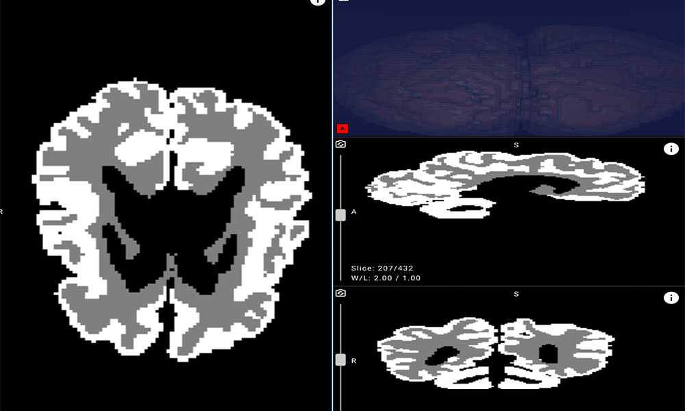 Yandex Yapay Zeka ile Bebek Beynini Okuyor